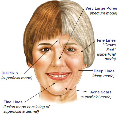 14 Rashes You Need to Know: Common Dermatologic Diagnoses